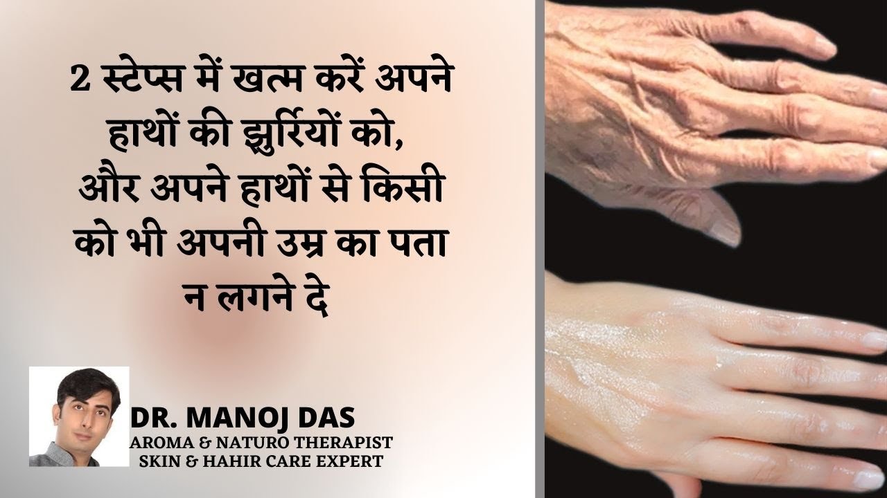 How To Make Your Hands Look 5 Years Younger! Wrinkle Free Smooth Hands | Dr. MANOJ DAS