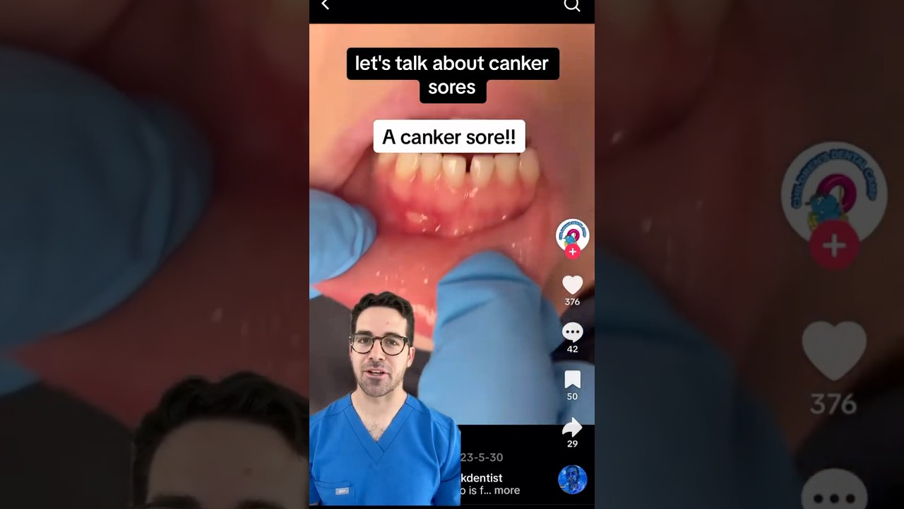What To Do If Your Child Has a Canker Sore 😣 | Dr. Yoshi&rsquo;s Mouth Pain Relief Tips