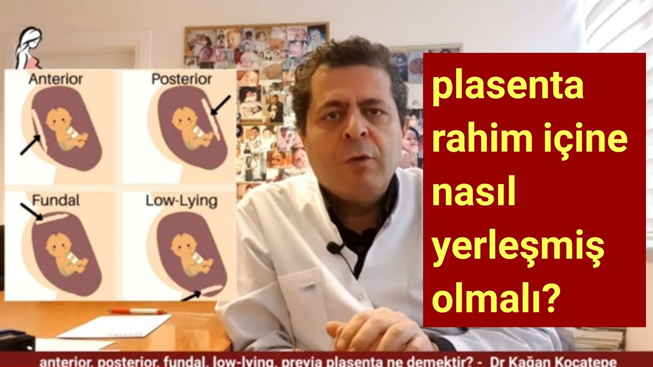 Plasenta normal rahim içi ideal yerleşimi nasıl olmalı? Posterior,anterior,fundal, low-lying nedir?