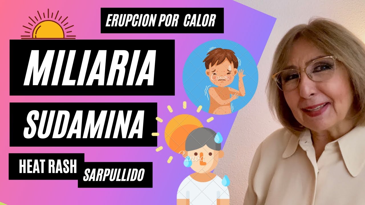 MILIARIA, SUDAMINA, SARPULLIDO, ERUPCIÓN POR CALOR o HEAT RASH. @depielapiel