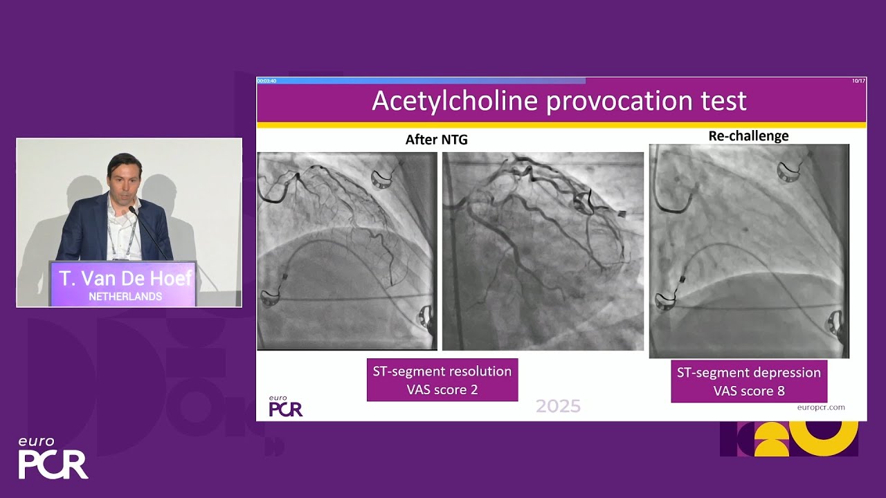 Full physiology: why and how to assess beyond coronary epicardial disease  - EuroPCR 2025