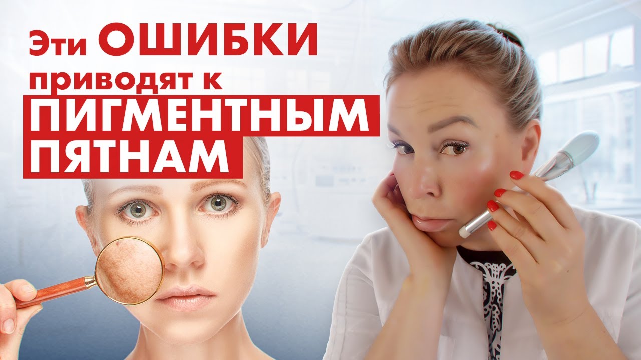 НЕ ДЕЛАЙ пилинг, если хочешь избавиться от пигментных пятен!