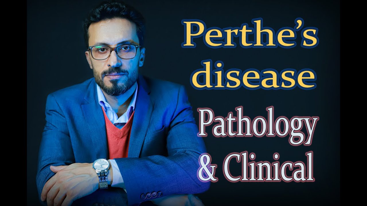 02 Perthe's disease: Pathology & Clinical