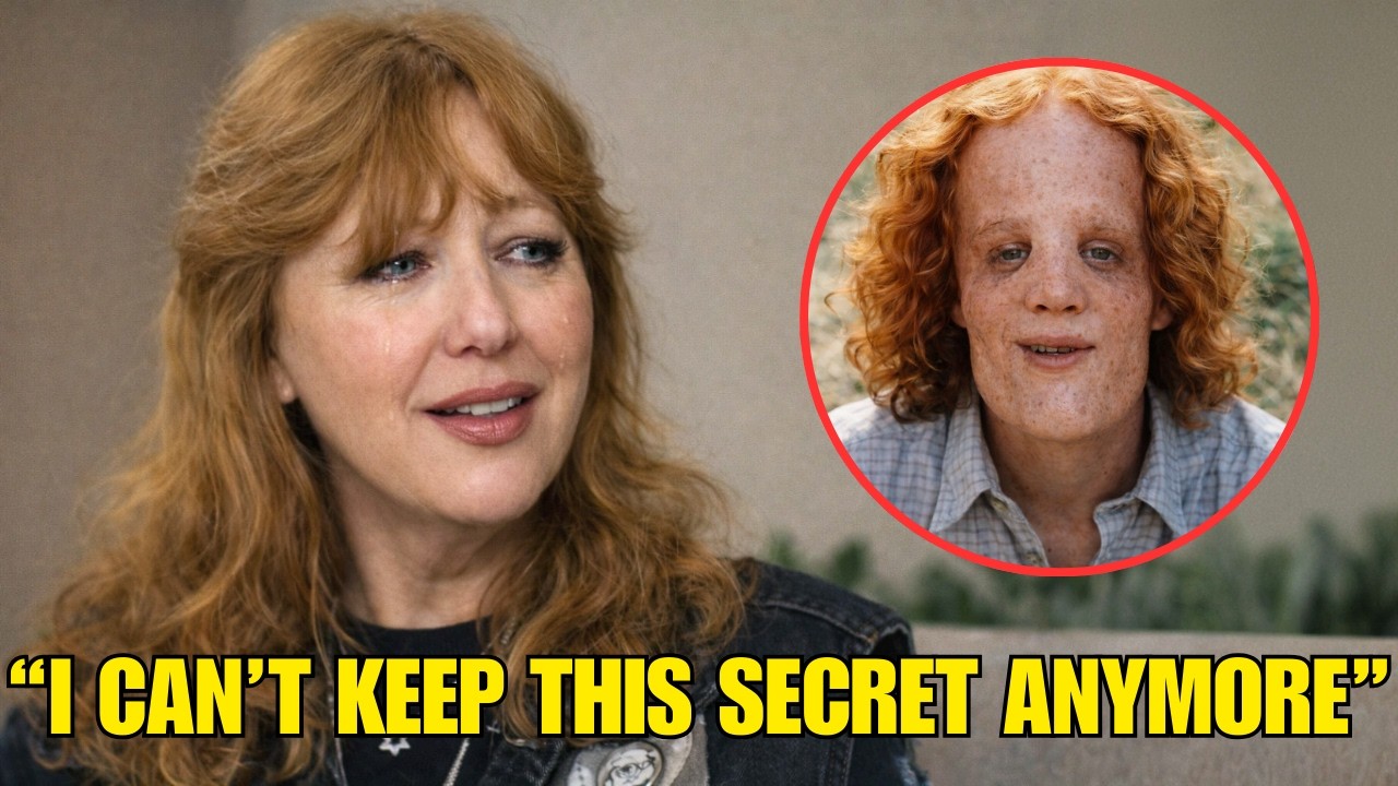 Before She Died, Rocky Dennis's Mom FINALLY Broke Silence About Rocky Dennis And It's SHOCKING