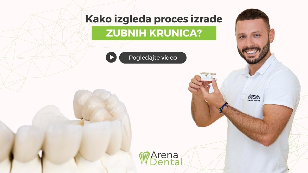 Kako izgleda proces izrade zubnih krunica? | Arena Dental
