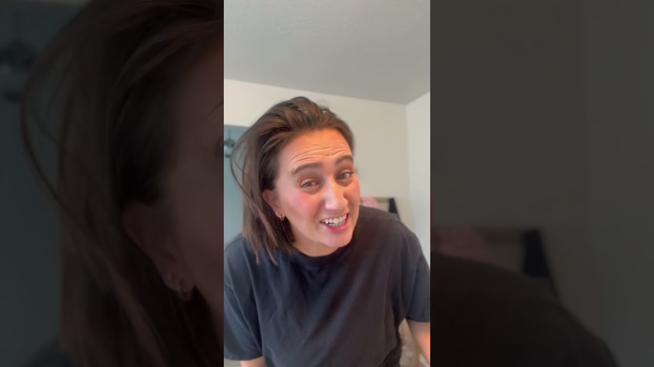 Covering up my bald spots from alopecia