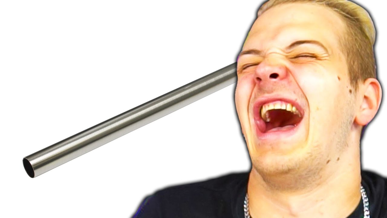 Aua...diese Weddit Beiträge tun weh 🧠