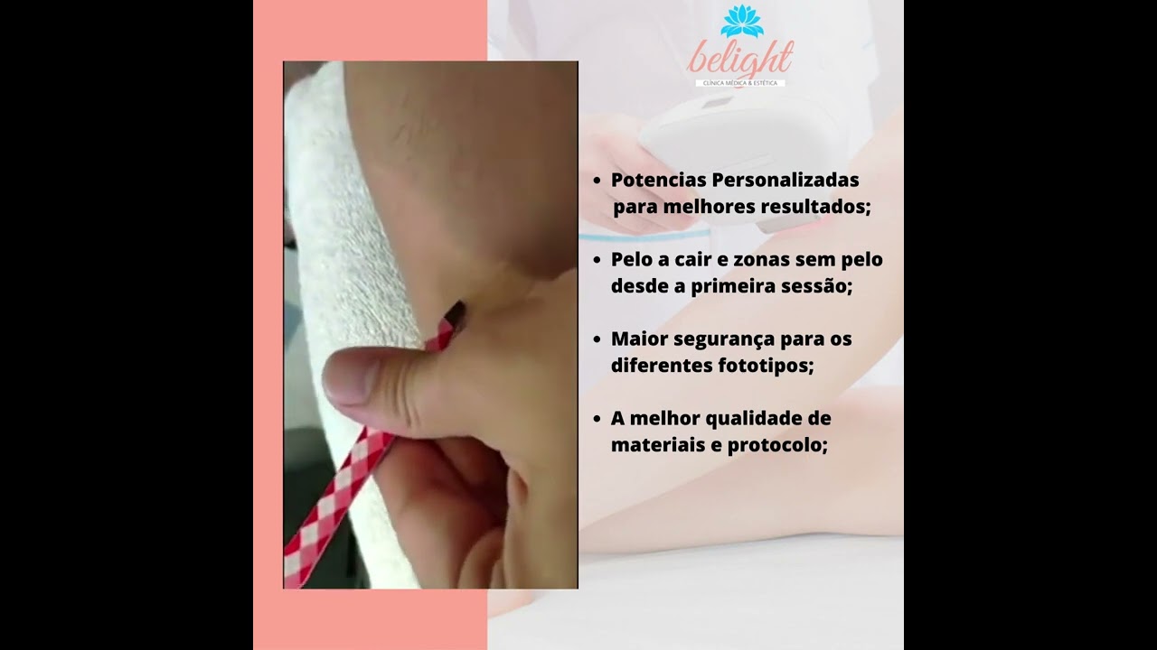 belight depilação laser