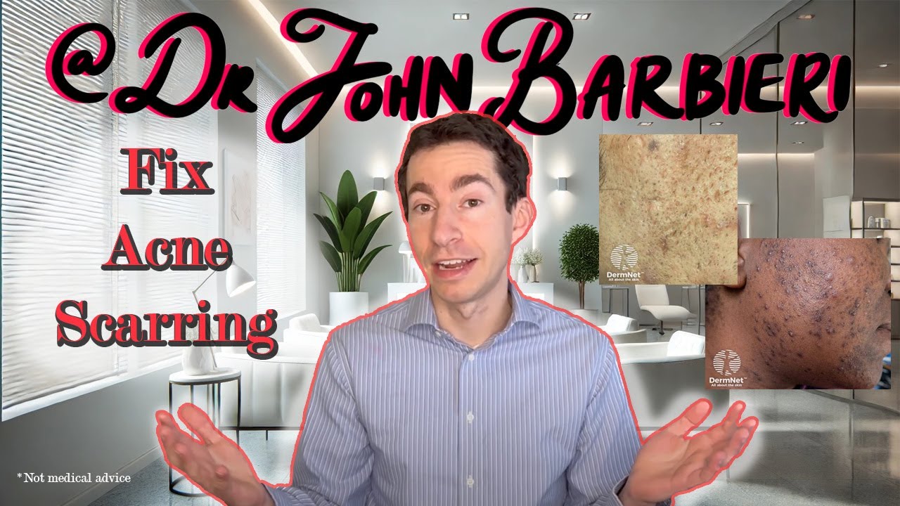 How to Treat Every Type of Acne Scar: Dermatologist and Acne Expert Explains