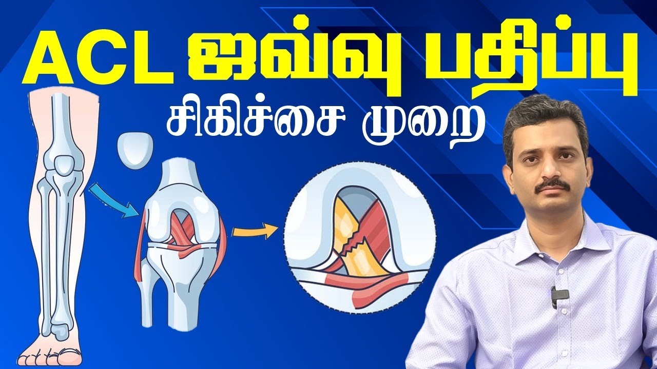 ACL  ஜவ்வு பாதிப்பு ACL Ligament tear injury & Treatmeny in Tamil | Dr Balaji  Atlas Hospital Trichy