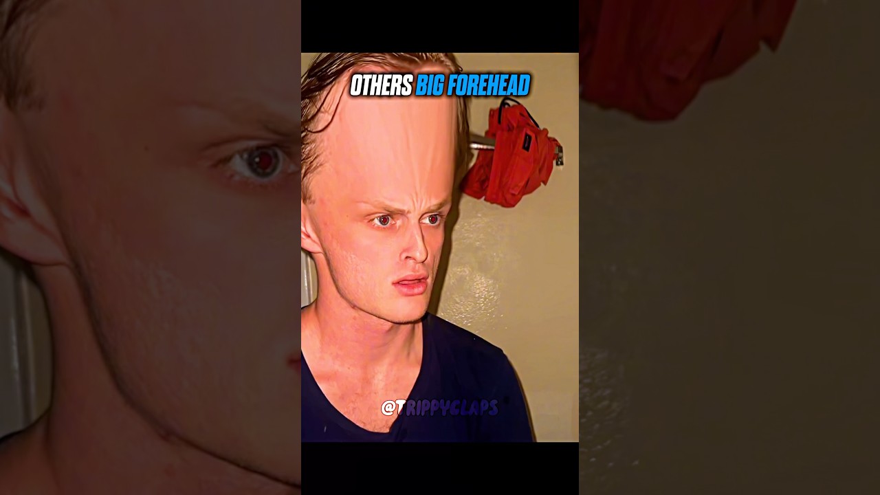 Others big forehead vs this one 🗿