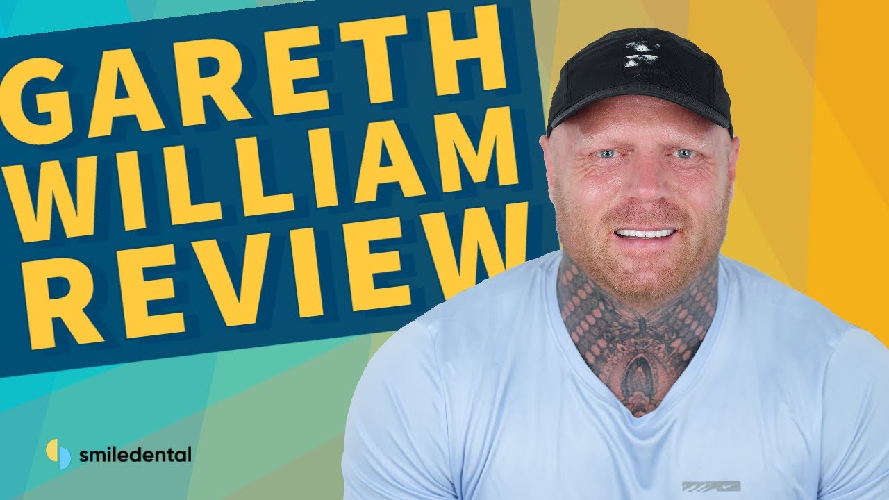 Smile Dental Turkey Reviews [Gareth William From United Kingdom] (2022)