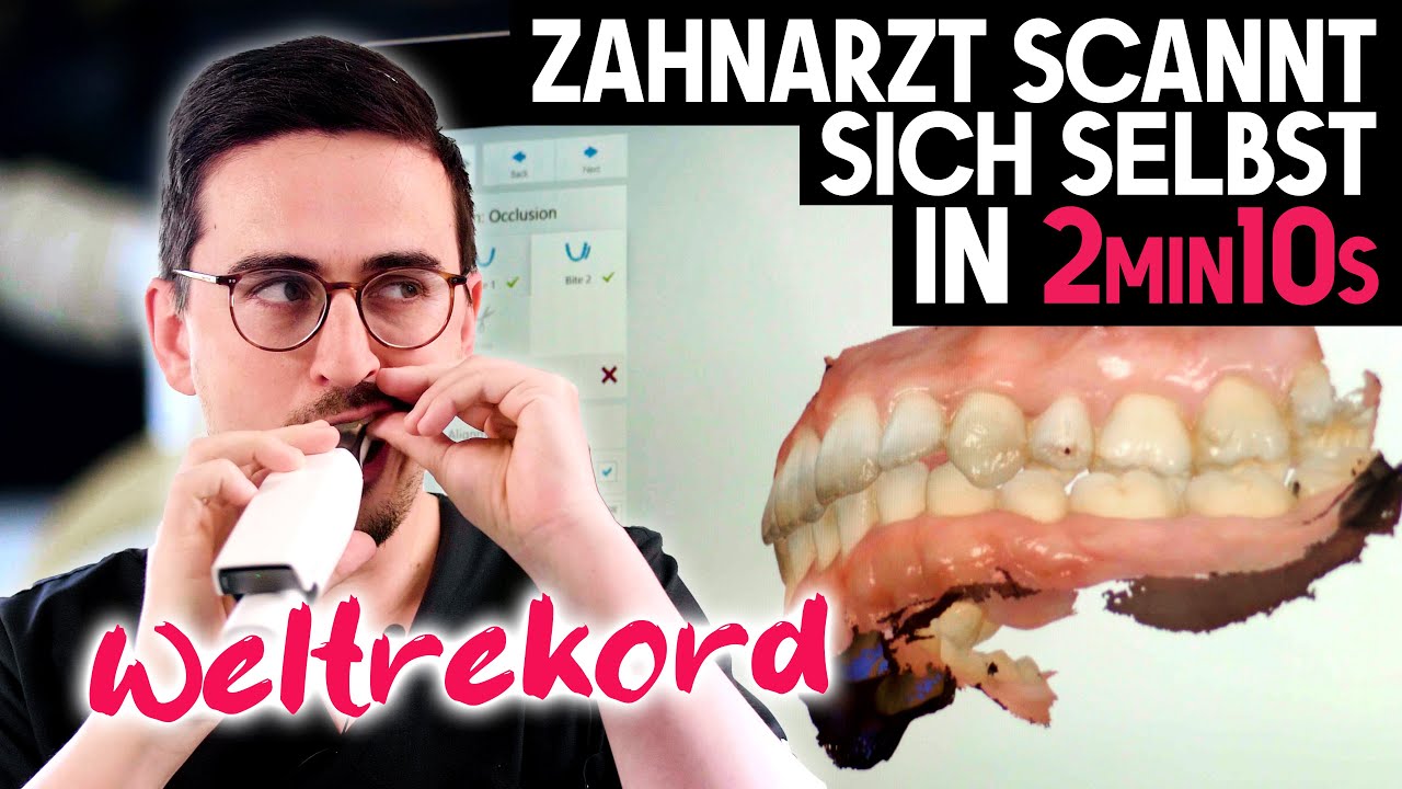 Intraoralscan | Ich scanne mich selbst!