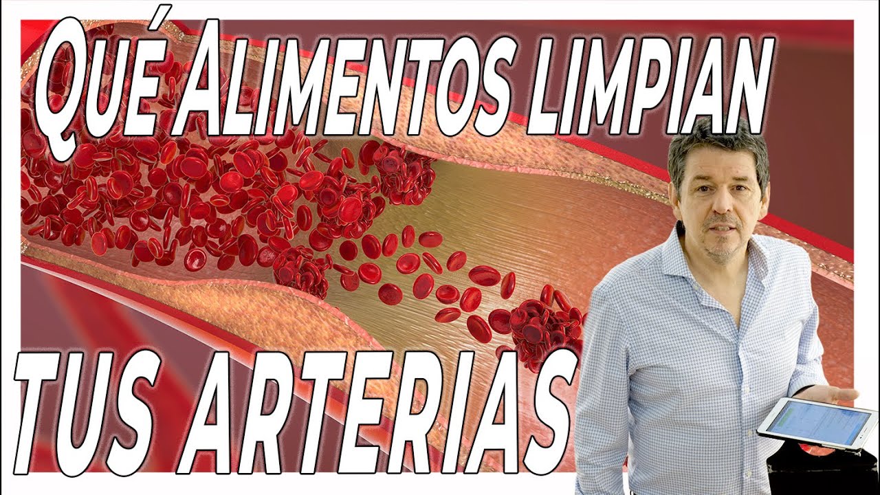 ESTOS son Los MEJORES ALIMENTOS para LIMPIAR tus ARTERIAS