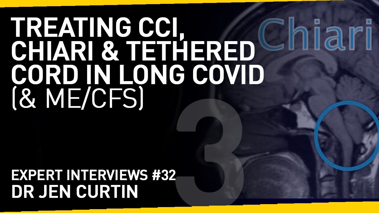Diagnosis and Treatment of CCI, Chiari & Tethered Cord in Long Covid and ME/CFS