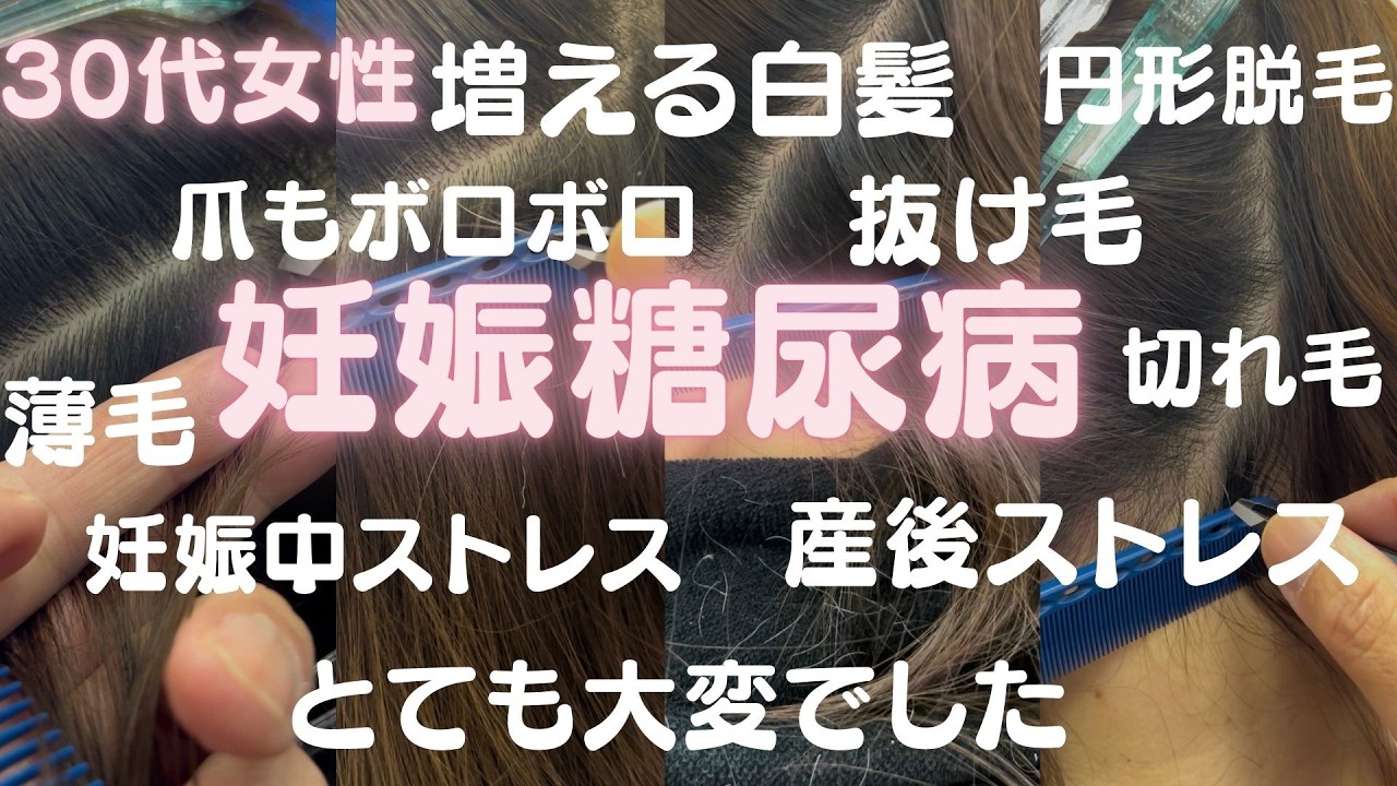 妊娠糖尿病でストレスで白髪も増え、薄毛になり、髪もくせ毛になり、爪もボロボロ、成長しない髪、とてもとても大変だったお話です。今は白髪を抜いてストレス解消！パンドガールで髪も、爪も回復しました。