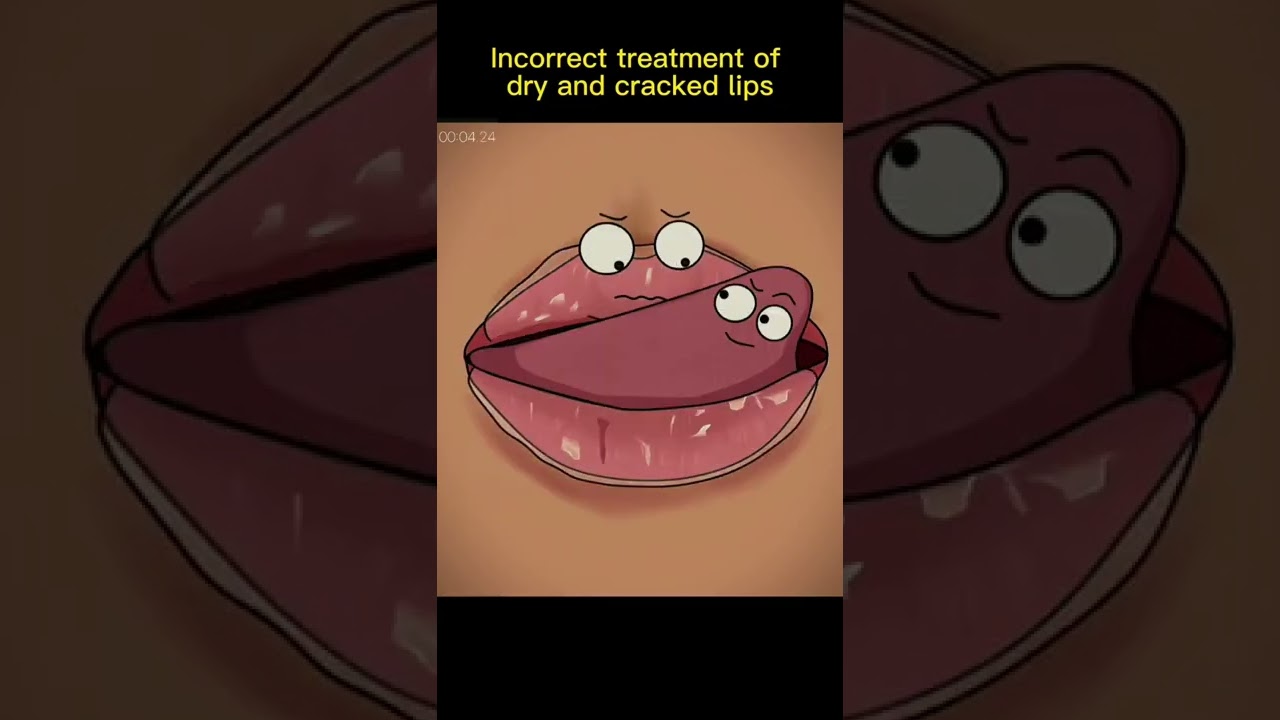 Dry And Cracked lips