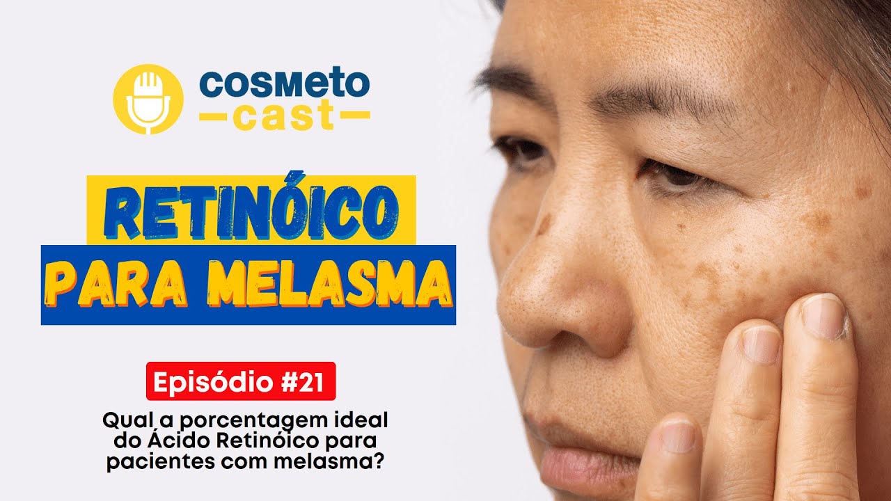 QUAL A PORCENTAGEM IDEAL DO ÁCIDO RETINOICO PARA PACIENTES COM MELASMA I CosmetoCast #21 #podcast