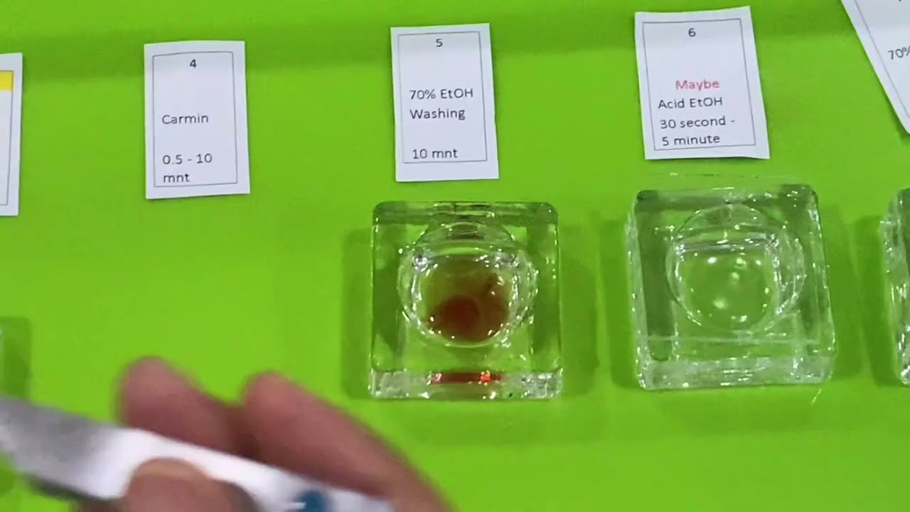 Staining Prosedure of Digenea and Cestoda