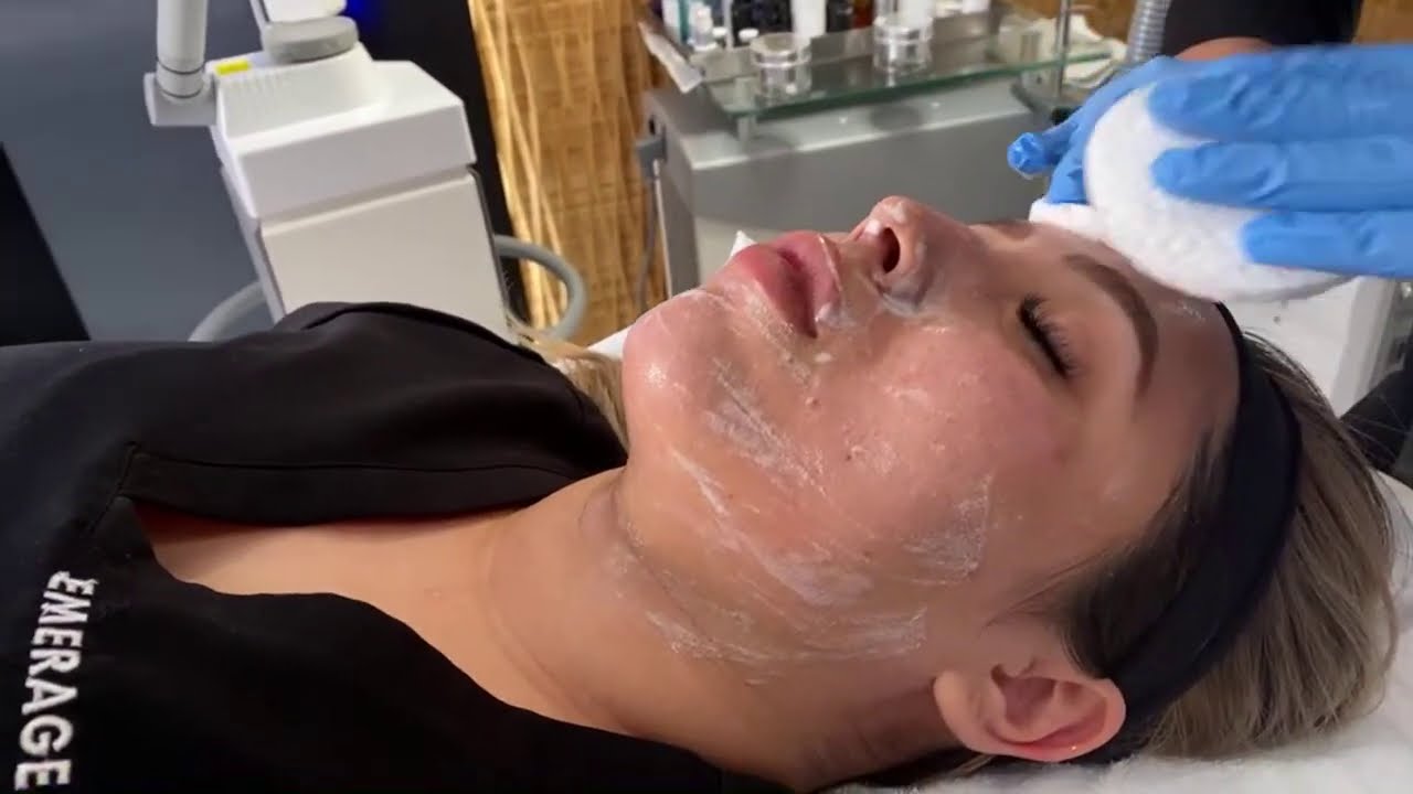 ЛУЧШАЯ ЭКСТРАКЦИЯ ДЛЯ ЛИЦА ОТ БЕЛЫХ И ЧЕРНЫХ ТОЧЕК | DIAMOND TIP DERMALINFUSION | Доктор Джейсон ...