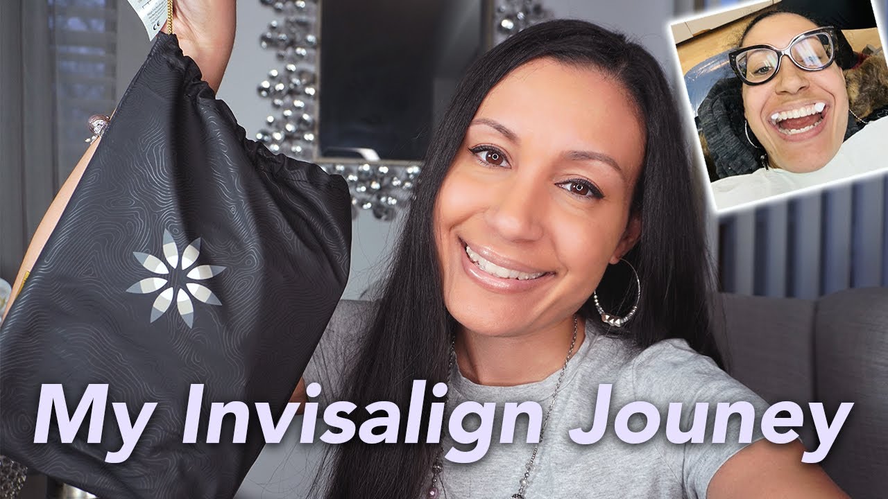 My Invisalign Journey - 1 month in - What they don't tell you!