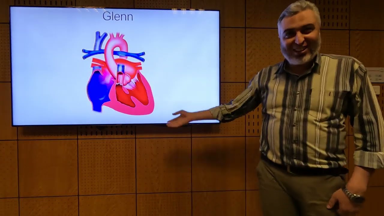 Single Ventricle Strategy - Hatem Hosny