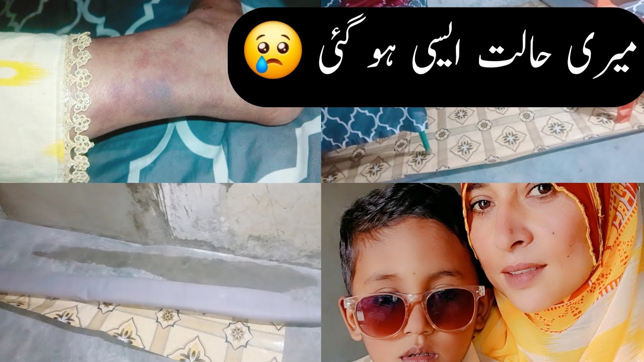 Mera paon jal gaya he jese || meri Halat kharab ho gai 😢 || Ayesha Single Mother 