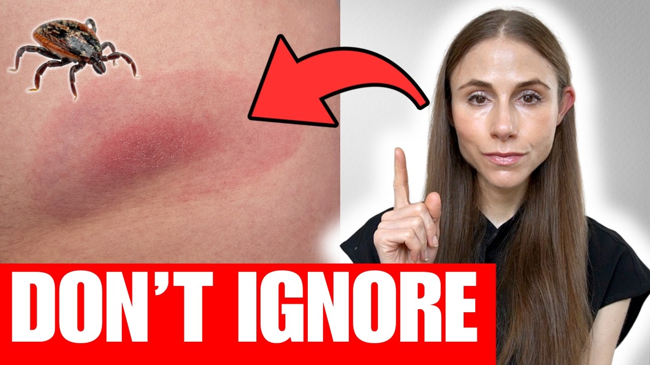 Lyme Disease Rash: The Skin Warning Signs You Should Never Ignore