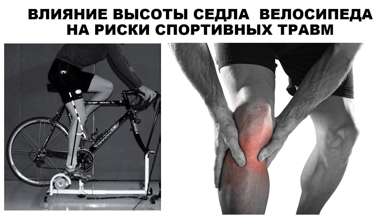 ВЛИЯНИЕ ВЫСОТЫ СЕДЛА ВЕЛОСИПЕДА НА РИСКИ СПОРТИВНЫХ ТРАВМ