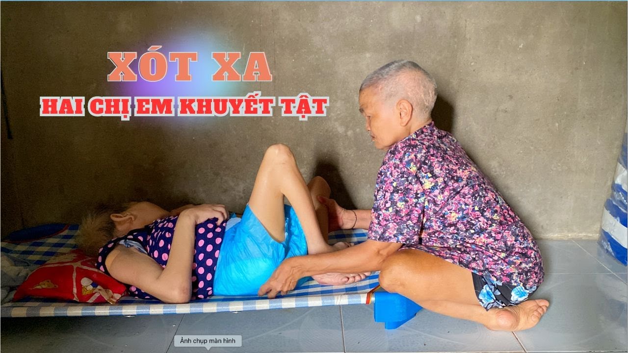Chị khuyết tật chỉ dám ăn cơm với muối, để dành tiền duy trì sự sống cho em