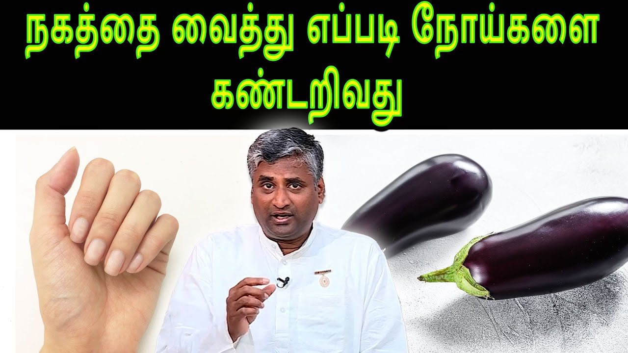 தினமும் கத்தரிக்காய் சாப்பிட்டால் இந்த நோய்கள் எல்லாம் குணமாகும்!!