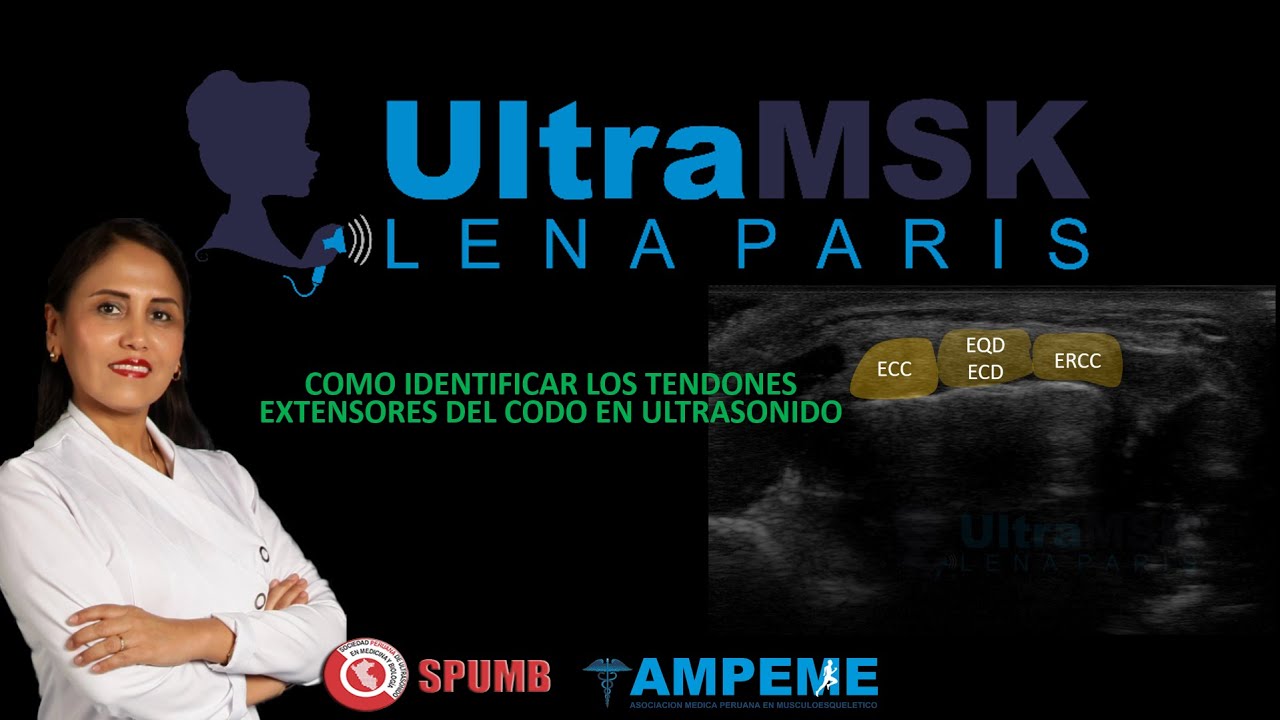 COMO EVALUAR EL CODO EN ULTRASONIDO / EXTENSOR TENDONS ELBOW ULTRASOUND