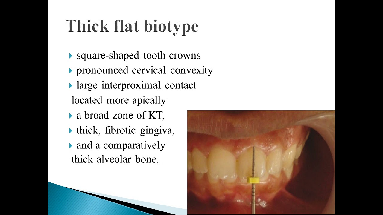 periodontal biotypes