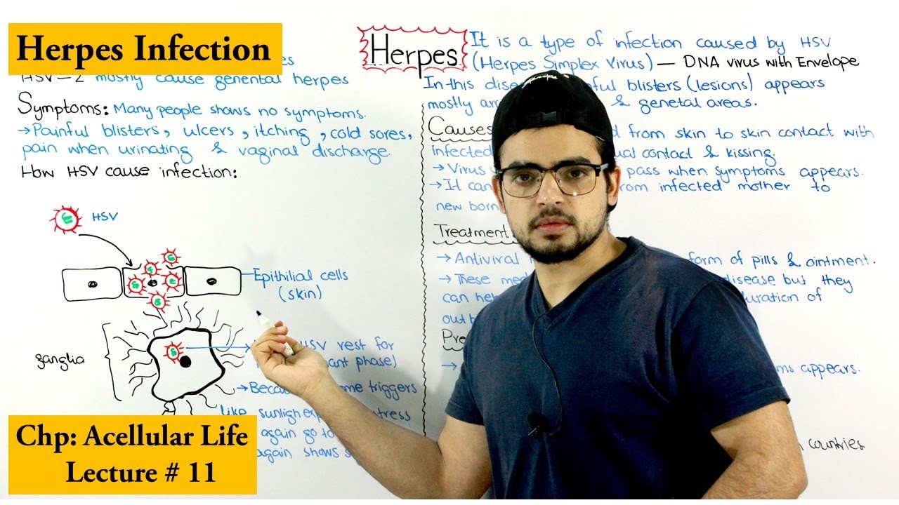 Herpes disease |Causes, Symptoms, Prevention and Treatment|
