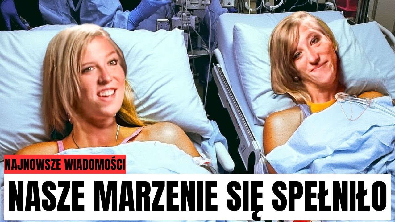 Bliźniaczki syjamskie NIESPODZIANKA! Zostaliśmy rozdzieleni!