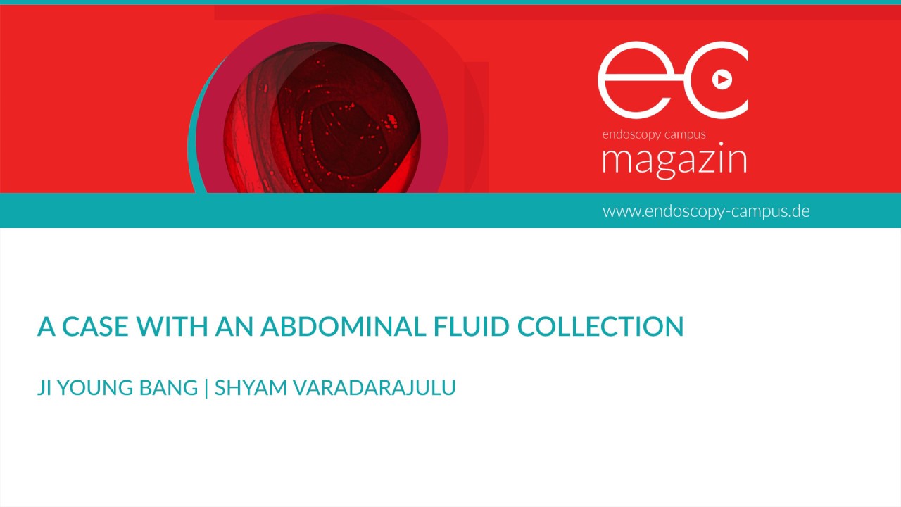 A Case with an Abdominal Fluid Collection