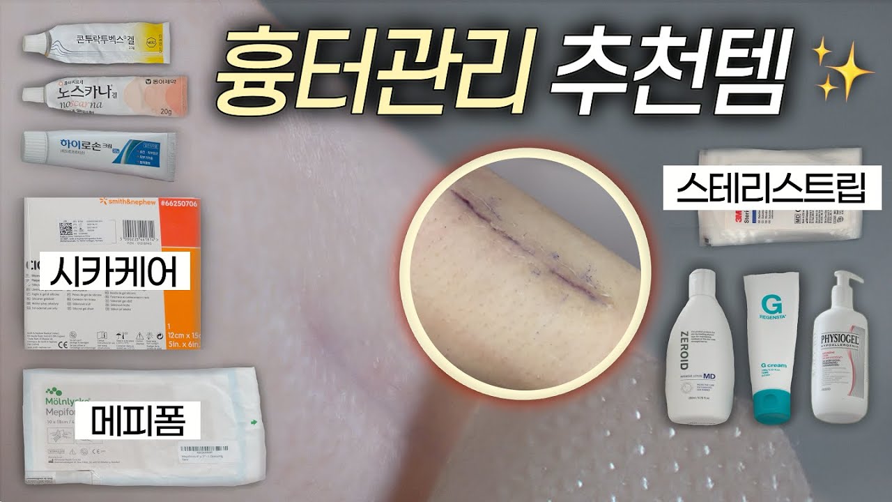 흉터 관리에 진심이었다..🔥수술 세 번 받으며 쌓은 흉터 관리법 총 공개 l 시카케어 메피폼 등 인기템 소개부터 흉터 연고 추천까지 l 10개월간의 마지막 수술 흉터 관리 기록