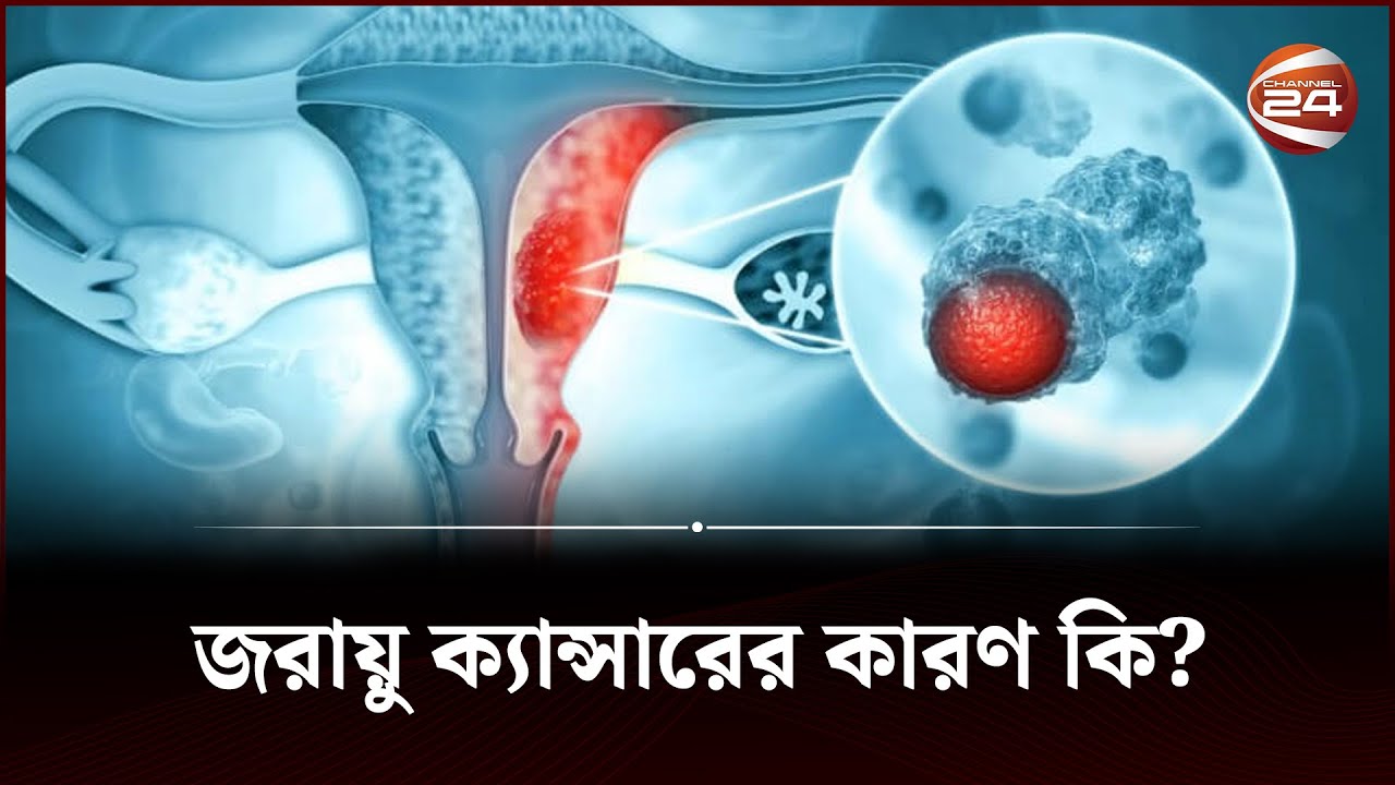 জরায়ু ক্যান্সারের কারণ কি? | Uterine Cancer | Health Tips | Channel 24