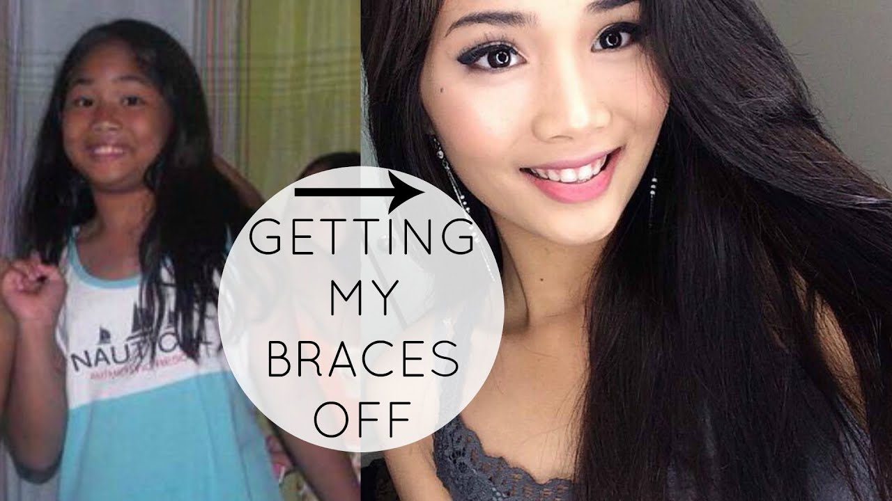 Getting My Braces Off! | 2016 Jemi Vlog #1