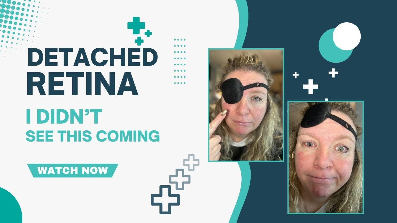 My Detached Retina Surgery Journey: Recovery, Challenges, and Post-Op Life
