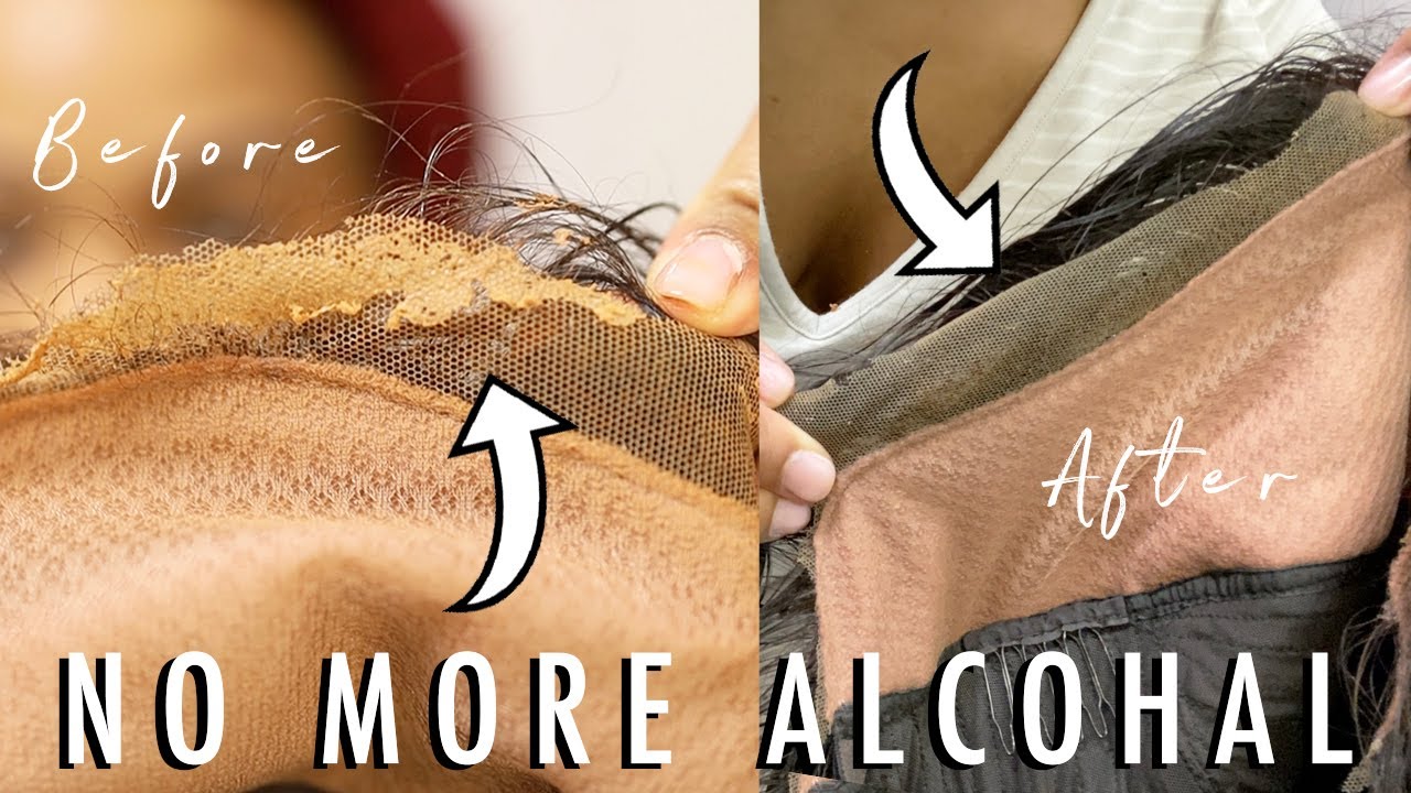 HOW TO: Safely REMOVE GLUE off your lace wig AND SKIN | EASY & QUICK & SAFE