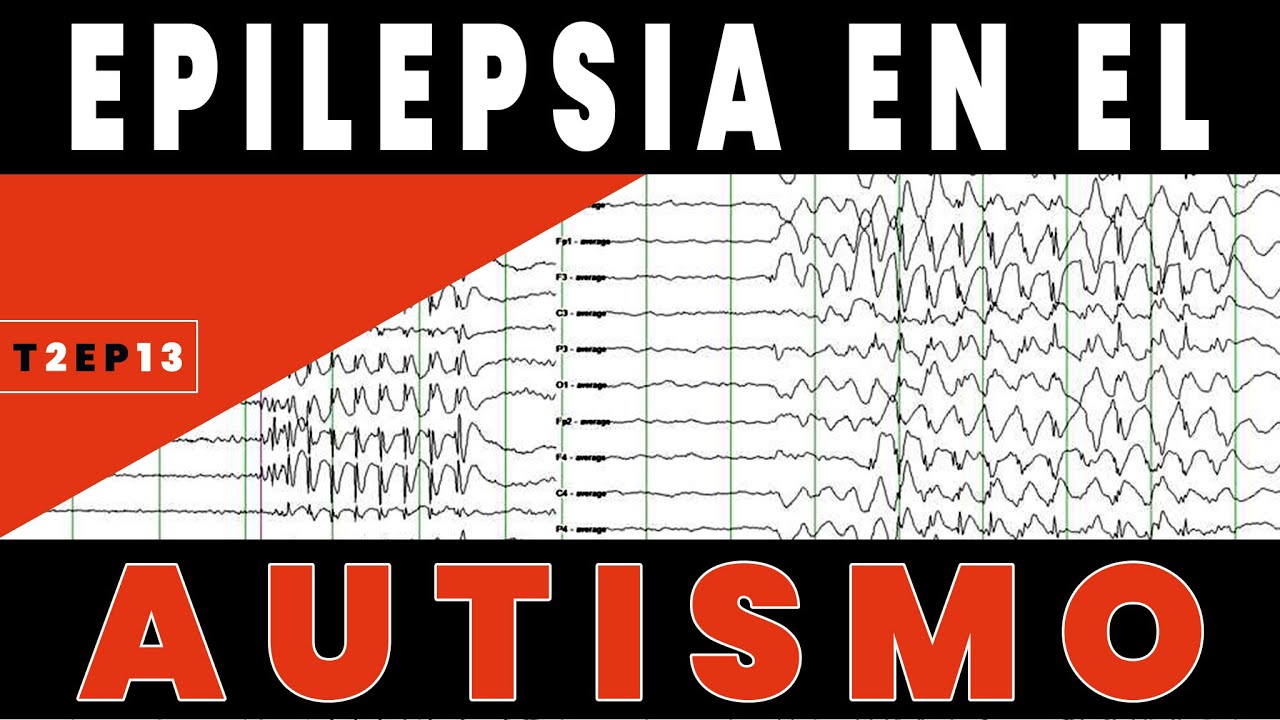 Epilepsia En El Autismo  | T2 - Episodio 13 | Tertuliando El Autismo