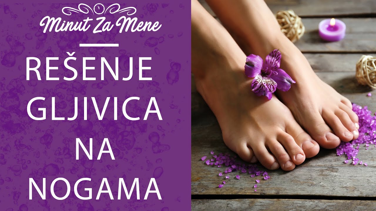 GLJIVICE NA NOGAMA i sve &scaron;to treba da znate da bi ih se RE&Scaron;ILI!