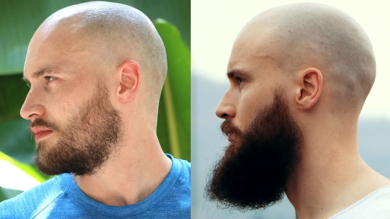 Thin Beard To Winning Beard And Back *My Entire Beard Journey*