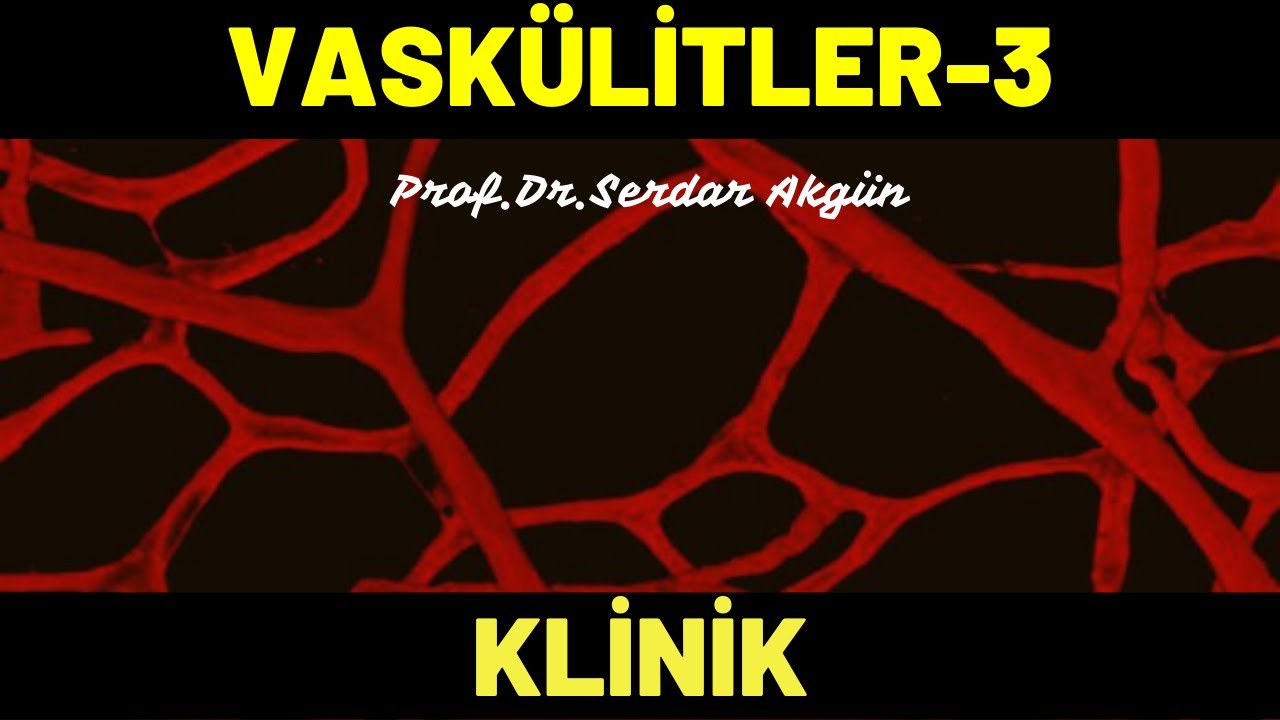 Vaskülitler, 3, Klinik, Tıp Dersleri, Serdar Akgün Tıp Videoları
