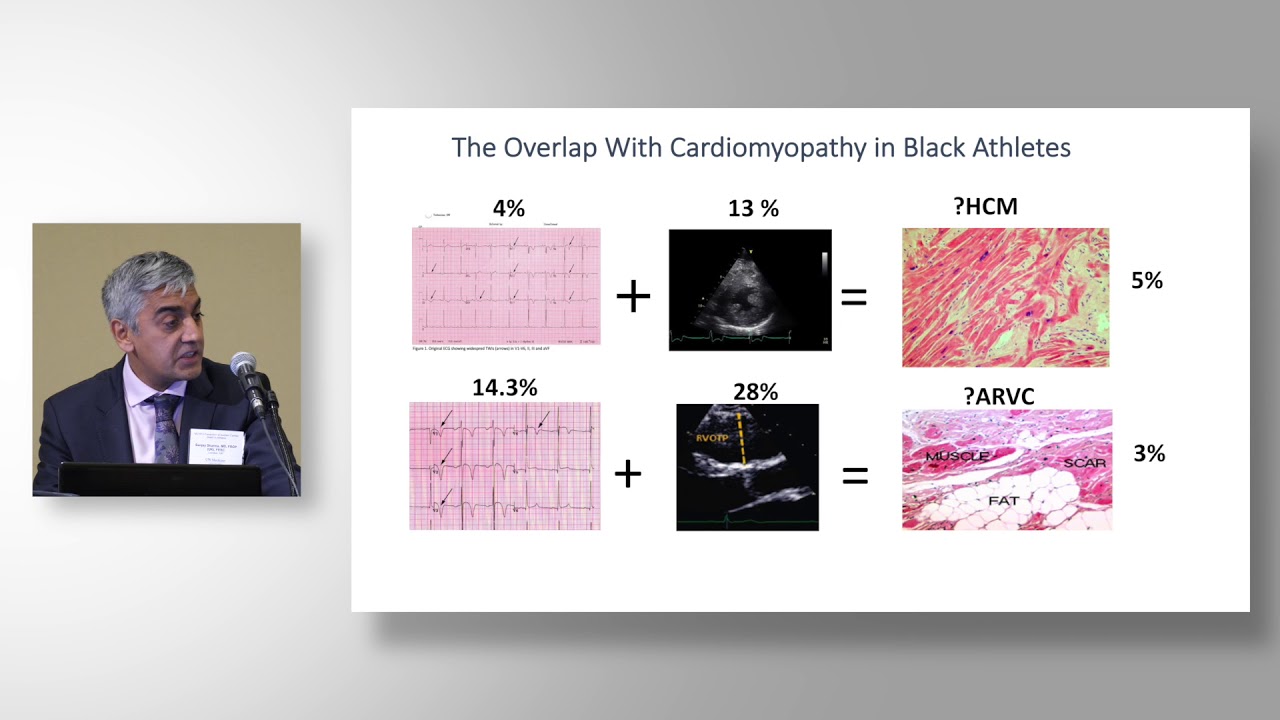 Sanjay Sharma, MD, Repolarization Variants in Black Athletes  What We Know and Don’t Know