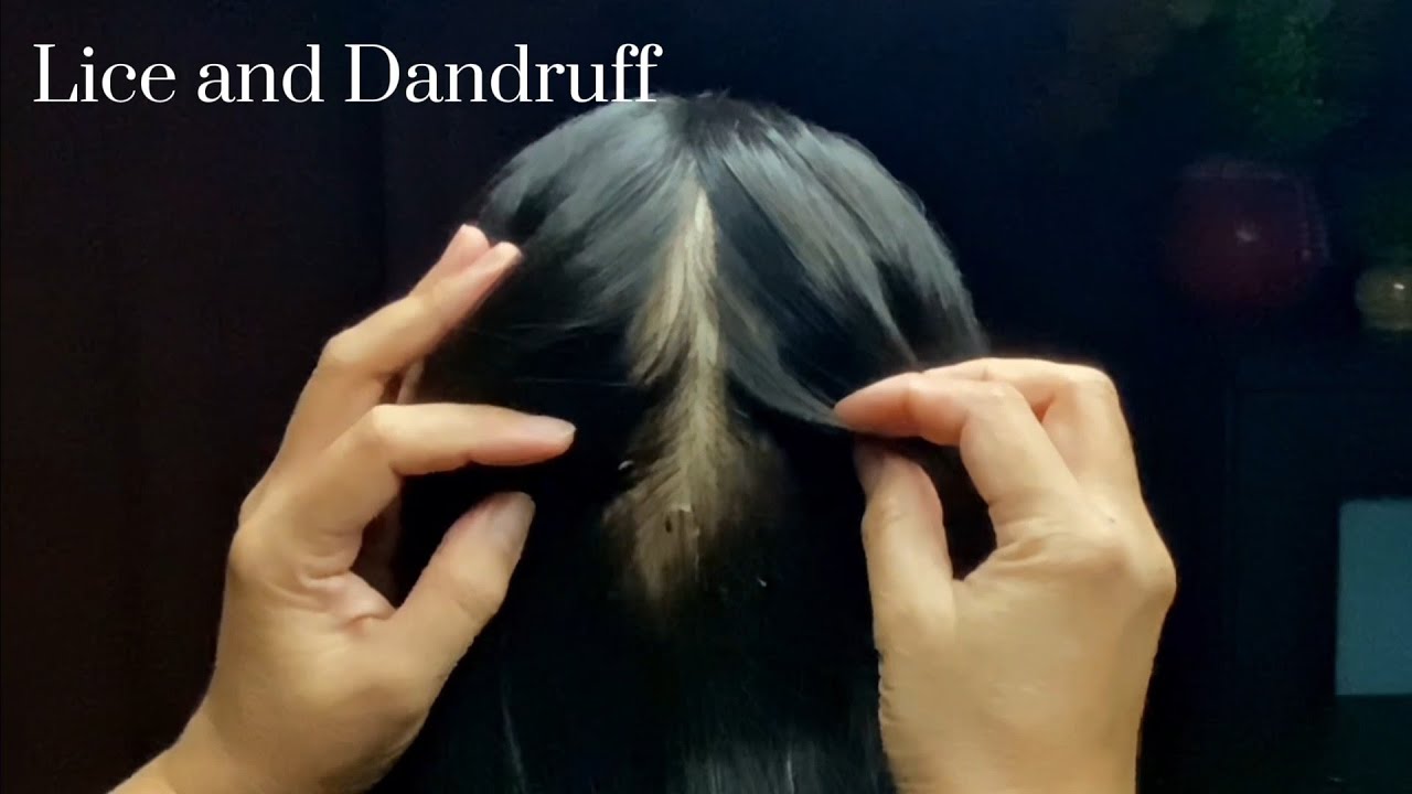 Lice Remove and Dandruff Removal | No Talking 😴💤🥱