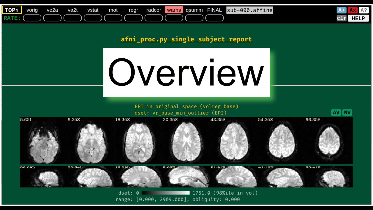 [AFNI Academy] APQC HTML: Overview