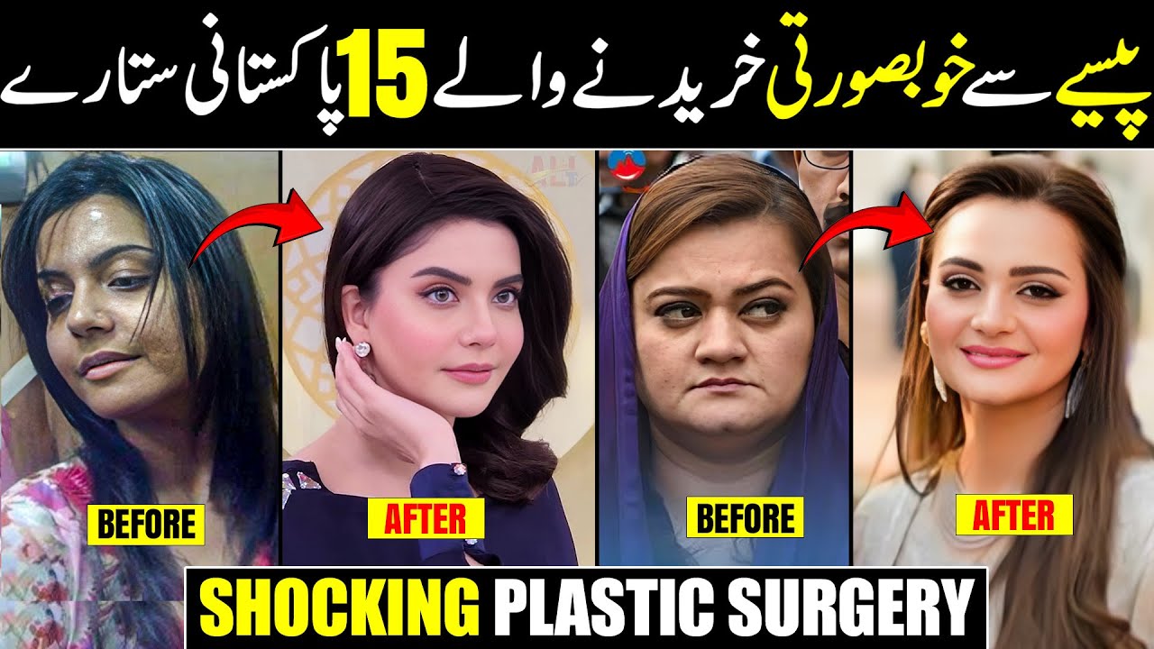 15 Pakistani Celebrities Who Allegedly Changed Their Faces with Plastic Surgery | Shocking Surgeries
