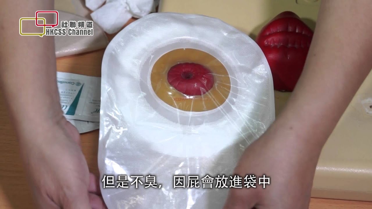 平等看待「造口人」